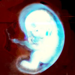 Embryo