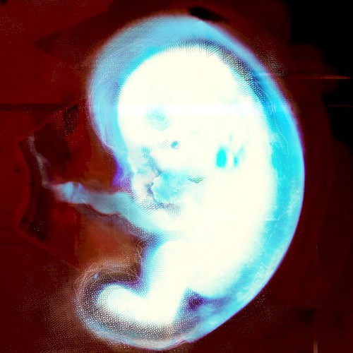 Embryo