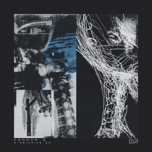 Dismissive EP