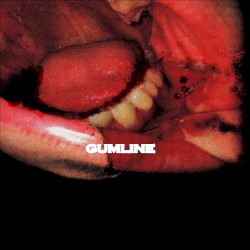 Gumline
