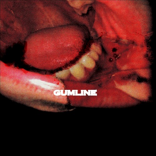 Gumline