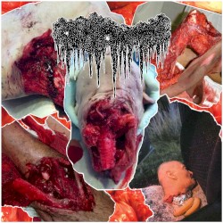Forensic Findings Following the Autopsy