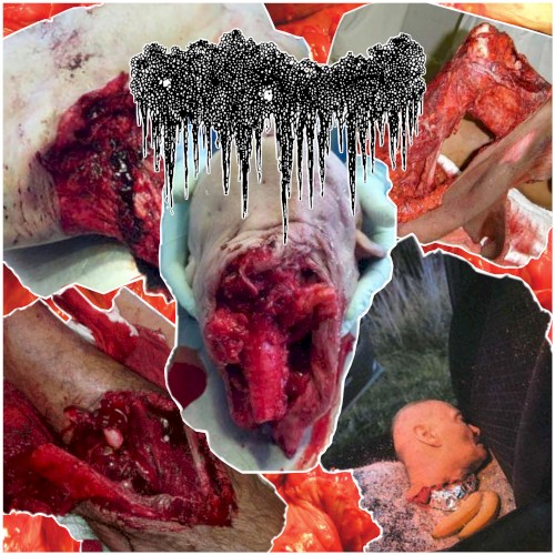 Forensic Findings Following the Autopsy