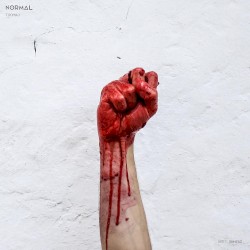 Normal