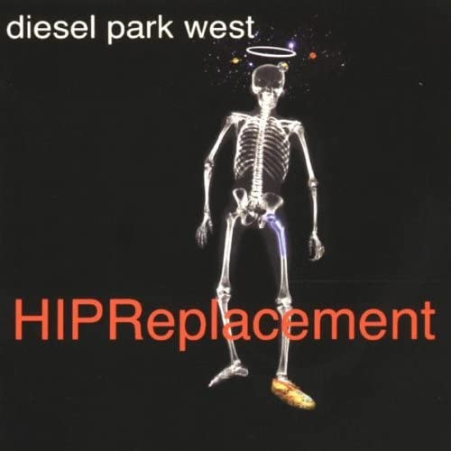 Hip Replacement