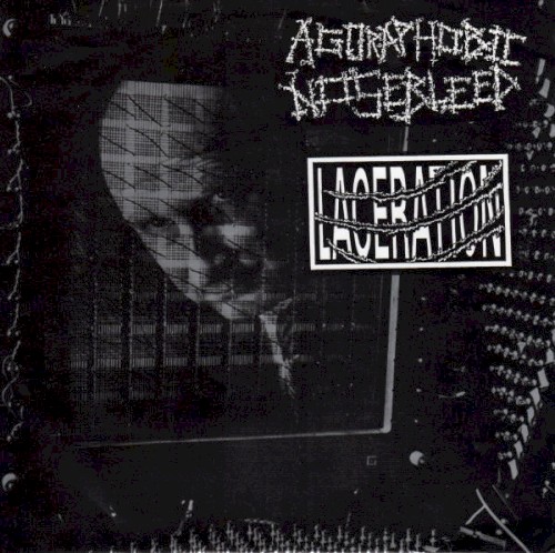 Agoraphobic Nosebleed / Laceration