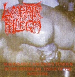 Malignant Cancerous Tumour in the Epithelial Tissue of the Intestine / From Rotten Process... To Splatter