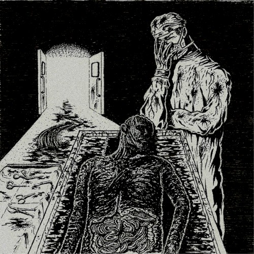 Irreversible Surgical Failure