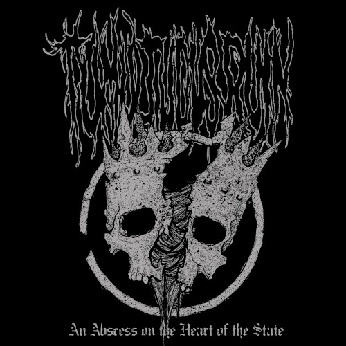 An Abscess on the Heart of the State