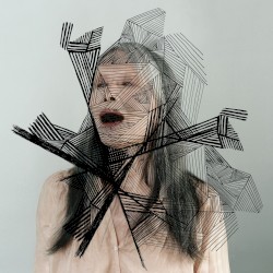 Epilepsy Is Dancing