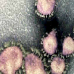 oolXloo: Virus Singles