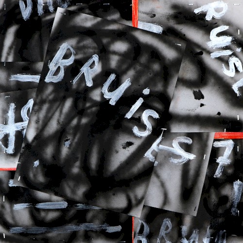 Bruises