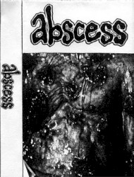 Abscess