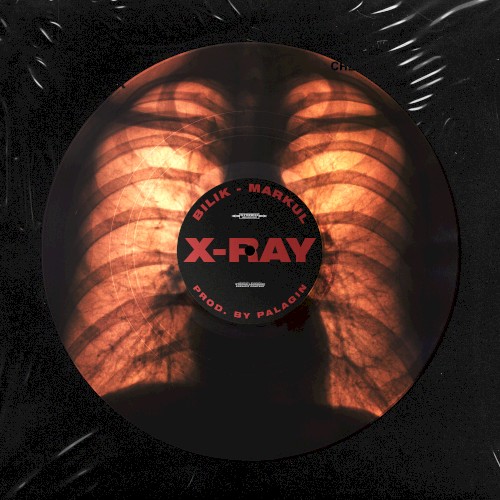 X‐Ray