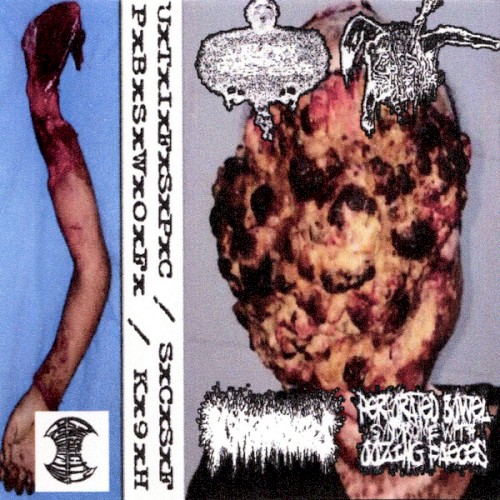 Urinary Tract Infection From Severe Pus Clots / Schizophrenic Cannibalistic Sex Fest / K9 Hemorrhoids / Perforated Bowel Syndrome With Oozing Faeces