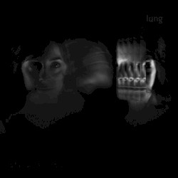Lung (Vines version)