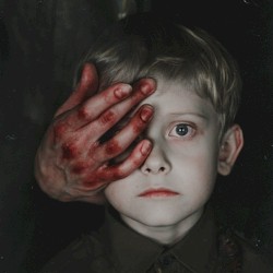 Losing Sight