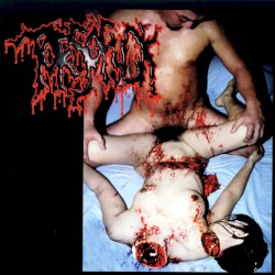 Disgusting Gore and Pathology / Polymorphisms to Severe Sepsis in Trauma