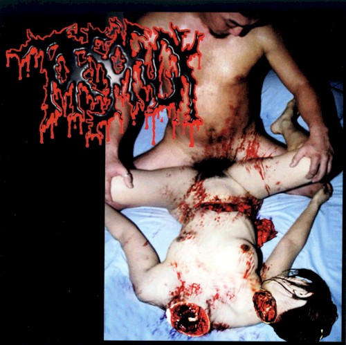 Disgusting Gore and Pathology / Polymorphisms to Severe Sepsis in Trauma