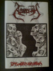 Dysmorphophobia