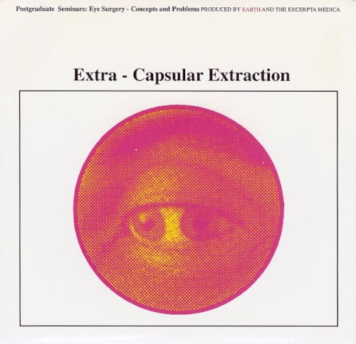 Extra‐Capsular Extraction