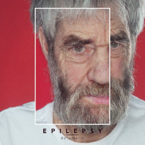 Epilepsy