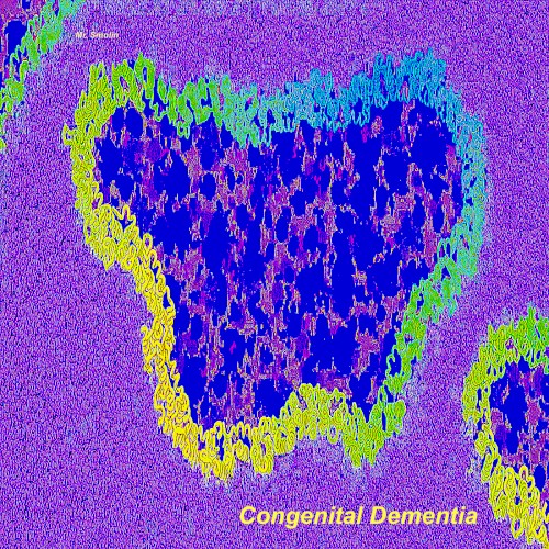 Congenital Dementia