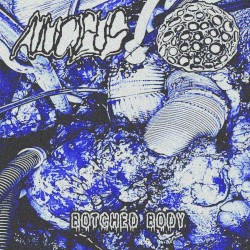 Botched Body