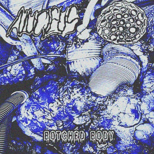 Botched Body