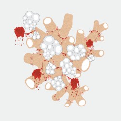 The Exquisite Death of Saxon Shore
