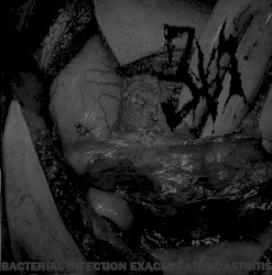 Bacterial Infection Exacerbates Gastriti