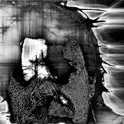 Psychotic Episodes