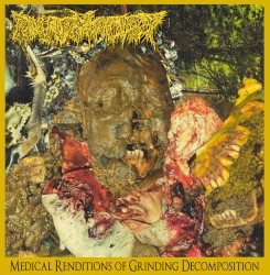 Medical Renditions of Grinding Decomposition