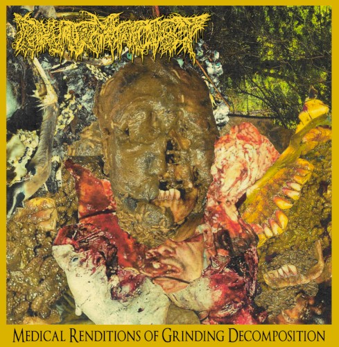 Medical Renditions of Grinding Decomposition