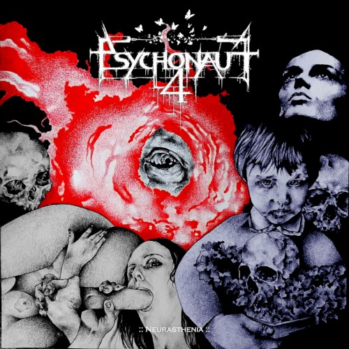 Neurasthenia