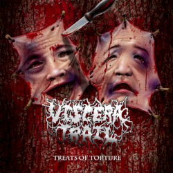 Treats of Torture