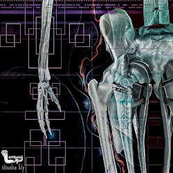Titanium Hip
