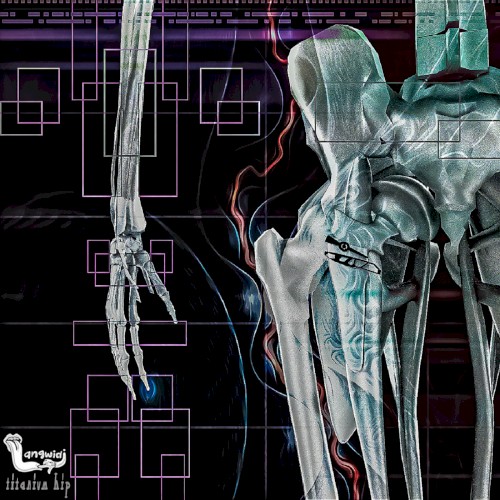 Titanium Hip