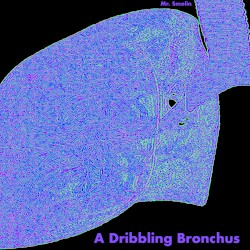 A Dribbling Bronchus