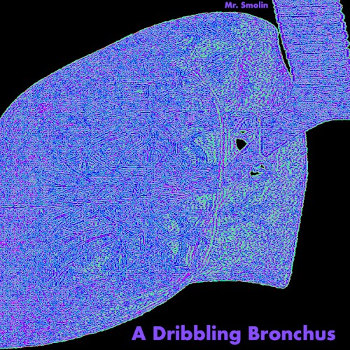 A Dribbling Bronchus