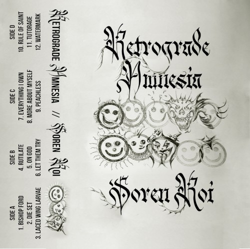 Retrograde Amnesia