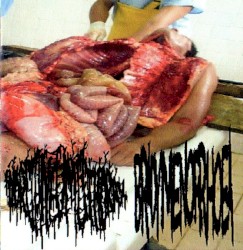 Hydropneumothorax / Bradymenorrhoea