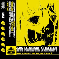 JAW REMOVAL SURGERY