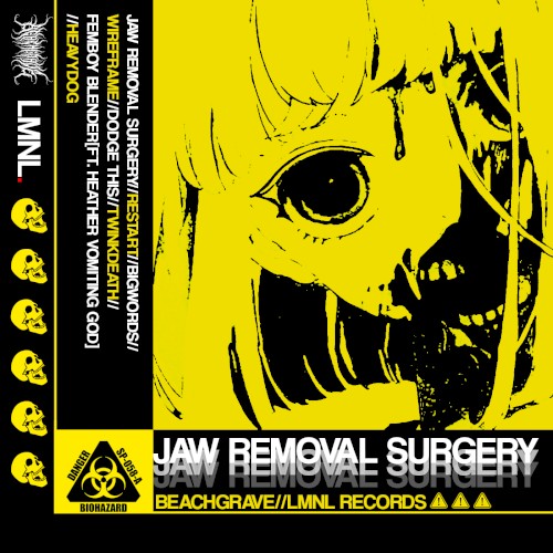 JAW REMOVAL SURGERY