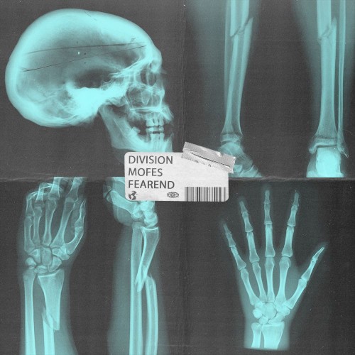 Fracture / Break