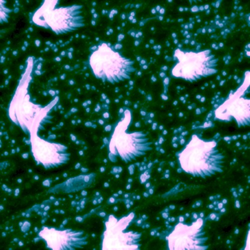 Evoking Potentials