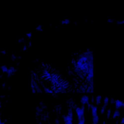 skeletal turmoil