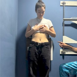 XRAYS