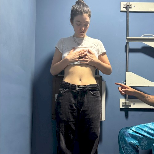 XRAYS