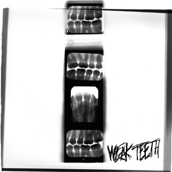 weak teeth